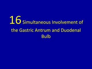 16Simultaneous Involvement of
the Gastric Antrum and Duodenal
Bulb
 