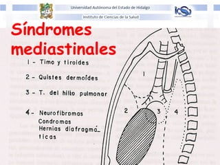 Síndromes
mediastinales
 