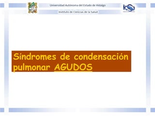 Síndromes de condensación
pulmonar AGUDOS
 