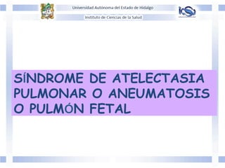 SÍNDROME DE ATELECTASIA
PULMONAR O ANEUMATOSIS
O PULMÓN FETAL
 