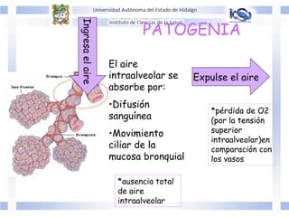 El aire
intraalveolar se
absorbe por:
• Difusión
sanguínea
• Movimiento
ciliar de la
mucosa bronquial
Expulse el aireIngresaelaire
PATOGENIA
*pérdida de O2
(por la tensión
superior
intraalveolar)en
comparación con
los vasos
*ausencia total
de aire
intraalveolar
 