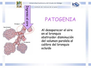 PATOGENIA
Ingresaelaire
Al desaparecer el aire
en el bronquio
obstruido= disminución
del volumen paralela al
calibre del bronquio
ocluido
 