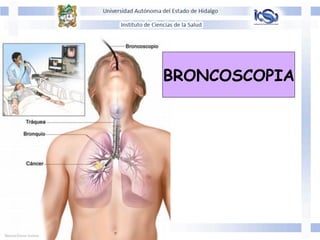BRONCOSCOPIA
 