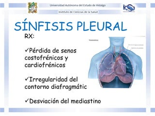 SÍNFISIS PLEURAL
RX:
ü Pérdida de senos
costofrénicos y
cardiofrénicos
ü Irregularidad del
contorno diafragmático
ü Desviación del mediastino
 