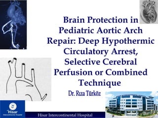 Hisar Intercontinental Hospital
Brain Protection in
Pediatric Aortic Arch
Repair: Deep Hypothermic
Circulatory Arrest,
Selective Cerebral
Perfusion or Combined
Technique
 
