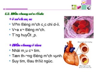 4.2. BiÕnchøngm¹ntÝnh:
+ëm¹chm¸u:
 Viªm ®éng m¹ch c¸c chi d­íi.
 V÷a x¬ ®éng m¹ch.
 T¨ng huyÕt ¸p.
+BiÕnchøngëtim:
 Nhåi m¸u c¬ tim.
 Tæn th­¬ng ®éng m¹ch vµnh.
 Suy tim, ®au th¾t ngùc.
 