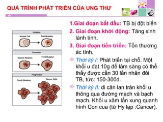 QUÁ TRÌNH PHÁT TRIỂN CỦA UNG THƯ
1.Giai đoạn bắt đầu: TB bị đột biến
2. Giai đoạn khởi động: Tăng sinh
lành tính.
3. Giai đoạn tiến triển: Tổn thương
ác tính.
 Thời kỳ I: Phát triển tại chỗ. Một
khối u đạt 10g để lâm sàng có thể
thấy được cần 30 lần nhân đôi
TB, tức: 150-300d.
 Thời kỳ II: di căn lan tràn khối u
thông qua đường mạch và bạch
mạch. Khối u xâm lấn xung quanh
hình Con cua (từ Hy lạp :Cancer).
 