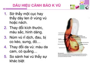 DẤU HIỆU CẢNH BÁO K VÚ
1. Sờ thấy một cục hay
thấy dày len ở vùng vú
hoặc nách.
2. Thay đổi kích thước,
màu sắc, hình dáng.
3. Núm vú rỉ dịch, đau, bị
co kéo, sưng, đỏ…
4. Thay đổi da vú: màu da
cam, có quầng…
5. So sánh hai vú thấy sự
khác biệt
 