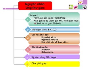 Xơ gan:
•80% xơ gan là do ROH (Pháp)
•Xơ gan là do Viêm gan MT, viêm gan virus
•K hoá từ xơ gan: 60-90%
1
Viêm gan virus: B,C,D,G2
Các hoá chất độc:
•Hợp chất vô cơ
•Hợp chất hữu cơ
•Hoá chất bảo vệ thực vật ....
3
Độc tố nấm mốc:
•Aflatoxin
•Ocharatoxin
4
5 Ký sinh trùng: Sán lá gan
6
Chất phóng xạ.
Nguyên nhân
Ung thư gan:
 