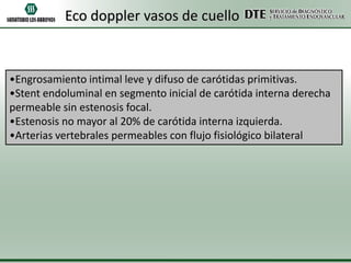 Eco doppler vasos de cuello

•Engrosamiento intimal leve y difuso de carótidas primitivas.
•Stent endoluminal en segmento inicial de carótida interna derecha
permeable sin estenosis focal.
•Estenosis no mayor al 20% de carótida interna izquierda.
•Arterias vertebrales permeables con flujo fisiológico bilateral

 
