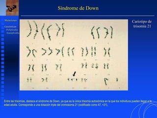 Síndrome de Down
Cariotipo de
trisomía 21
Mutaciones
Genómicas
Poliploidía
Aneuploidía
Entre las trisomías, destaca el síndrome de Down, ya que es la única trisomía autosómica en la que los individuos pueden llegar a la
edad adulta. Corresponde a una dotación triple del cromosoma 21 (codificado como 47, +21).
 