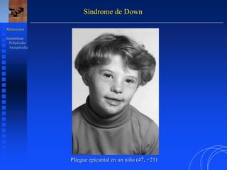 Síndrome de Down
Pliegue epicantal en un niño (47, +21)
Mutaciones
Genómicas
Poliploidía
Aneuploidía
 