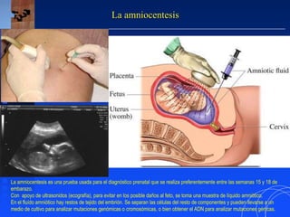 La amniocentesis
La amniocentesis es una prueba usada para el diagnóstico prenatal que se realiza preferentemente entre las semanas 15 y 18 de
embarazo.
Con apoyo de ultrasonidos (ecografía), para evitar en los posible daños al feto, se toma una muestra de líquido amniótico.
En el fluído amniótico hay restos de tejido del embrión. Se separan las células del resto de componentes y pueden llevarse a un
medio de cultivo para analizar mutaciones genómicas o cromosómicas, o bien obtener el ADN para analizar mutaciones génicas.
 