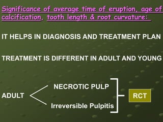 ROOT CANALSif 3 roots are present usually we can see 3 canals1. mesiobuccal    2. distobuccal    3. palatal if 4 canal is present   it is in mesiobuccal root but less frequently than in the 1 molar