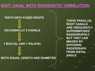 PRE TREATMENT RADIOGRAPHS The palatal canal is centered between the mesiobuccal and distobuccal roots in maxillary molars. When a second mesiobuccal canal (MB 2 ) is suspected, a mesial radiograph is often required to identify it. However, as thehorizontal angulation increases, the clarity of the radicular anatomy decreases. A 20 degree mesial shift is sufficient to separate the canals while limiting distortion.