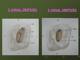Endo-Ray II film holder.the operator places the film parallel to the tooth and perpendicular tothe central ray and as far apical as possible
