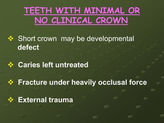 3 CANAL ORIFICES2 CANAL ORIFICES