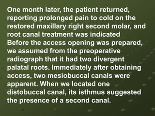 A Five-canal Maxillary Second Molar*May 2007, Volume 4, No.5  Journal of US -China Medical Science , ISSN1548-6648 USACASE REPORTThe patient was a 35 years old male who presented with a severe spontaneous pain in the maxillary right area which had been constant for one day. The medical status was unremarkable. Clinical examinations revealed that tooth-2 had deep mesio-occlusal caries without pulp exposure and was very sensitive to cold test. 