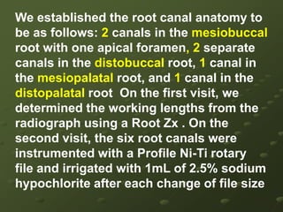 Radiographic examination disclosed an unusual anatomical configuration of the roots, suggesting that four roots might be present.A diagnosis of acute pulpitis was made for tooth-Following local anaesthesia an endodontic access opening was made and the pulp chamber was exposed clearly.