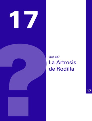17
Qué es?
La Artrosis
de Rodilla
 