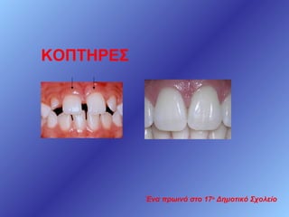 ΚΟΠΤΗΡΕΣ

Ένα πρωινό στο 17ο Δημοτικό Σχολείο

 