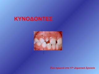 ΚΥΝΟΔΟΝΤΕΣ

Ένα πρωινό στο 17ο Δημοτικό Σχολείο

 