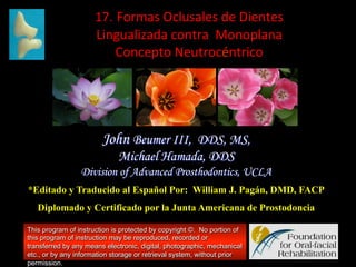 17.	
  Formas	
  Oclusales	
  de	
  Dientes	
  
Lingualizada	
  contra	
  	
  Monoplana	
  
Concepto	
  Neutrocéntrico	
  	
  

John Beumer III, DDS, MS,
Michael Hamada, DDS
Division of Advanced Prosthodontics, UCLA
*Editado y Traducido al Español Por: William J. Pagán, DMD, FACP
Diplomado y Certificado por la Junta Americana de Prostodoncia
This program of instruction is protected by copyright ©. No portion of
this program of instruction may be reproduced, recorded or
transferred by any means electronic, digital, photographic, mechanical
etc., or by any information storage or retrieval system, without prior
permission.

 