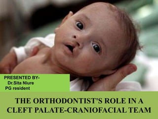 THE ORTHODONTIST'S ROLE IN A
CLEFT PALATE-CRANIOFACIAL TEAM1112
PRESENTED BY-
Dr.Sita Niure
PG resident
 
