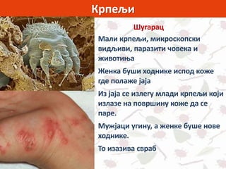 Крпељи
Шугарац
Мали крпељи, микроскопски
видљиви, паразити човека и
животиња
Женка буши ходнике испод коже
где полаже јаја
Из јаја се излегу млади крпељи који
излазе на површину коже да се
паре.
Мужјаци угину, а женке буше нове
ходнике.
То изазива свраб
 