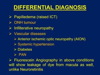 DIFFERENTIAL DIAGNOSIS
 Papilledema (raised ICT)
 ONH tumour
 Infilterative neuropathy
 Vascular diseases
 Anterior ischemic optic neuropathy (AION)
 Systemic hypertension
 Diabetes
 PAN
 Fluorescein Angiography in above conditions
will show leakage of dye from macula as well,
unlike Neuroretinitis
 