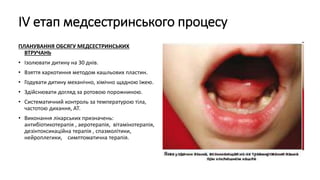 ІV етап медсестринського процесу
ПЛАНУВАННЯ ОБСЯГУ МЕДСЕСТРИНСЬКИХ
ВТРУЧАНЬ
• Ізолювати дитину на 30 днів.
• Взяття харкотиння методом кашльових пластин.
• Годувати дитину механічно, хімічно щадною їжею.
• Здійснювати догляд за ротовою порожниною.
• Систематичний контроль за температурою тіла,
частотою дихання, АТ.
• Виконання лікарських призначень:
антибіотикотерапія , аеротерапія, вітамінотерапія,
дезінтоксикаційна терапія , спазмолітики,
нейроплегики, симптоматична терапія.
 