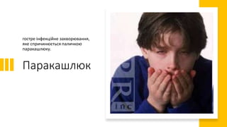 Паракашлюк
гостре інфекційне захворювання,
яке спричинюється паличкою
паракашлюку.
 