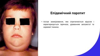 Епідемічний паротит
• гостре захворювання, яке спричинюється вірусом і
характеризується гарячкою, ураженням залозистої та
нервової тканини.
 