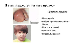ІІ етап медсестринського процесу
Проблеми пацієнта
• Гіпертермія.
• Набряк привушних слинних
залоз.
• Біль при жуванні.
• Головний біль.
• Нудота, блювання
 
