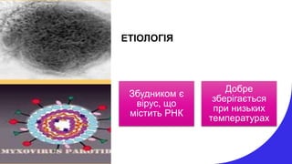 ЕТІОЛОГІЯ
Збудником є
вірус, що
містить РНК
Добре
зберігається
при низьких
температурах
 