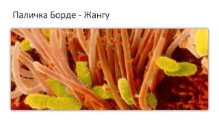 Паличка Борде - Жангу
 