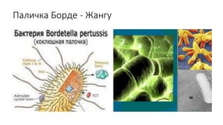 Паличка Борде - Жангу
 