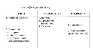 Класифікація кашлюку
ТИП ТЯЖКІСТЬ ПЕРЕБІГ
1.Типові форми 1.Легка.
2.Средньої
тяжкості.
3.Тяжка.
2.Атипові:
 стерта;
 абортивна;
 субклінічна;
 безсимптомна.
1.Гладкий.
2.Негладкий
(ускладнений)
 