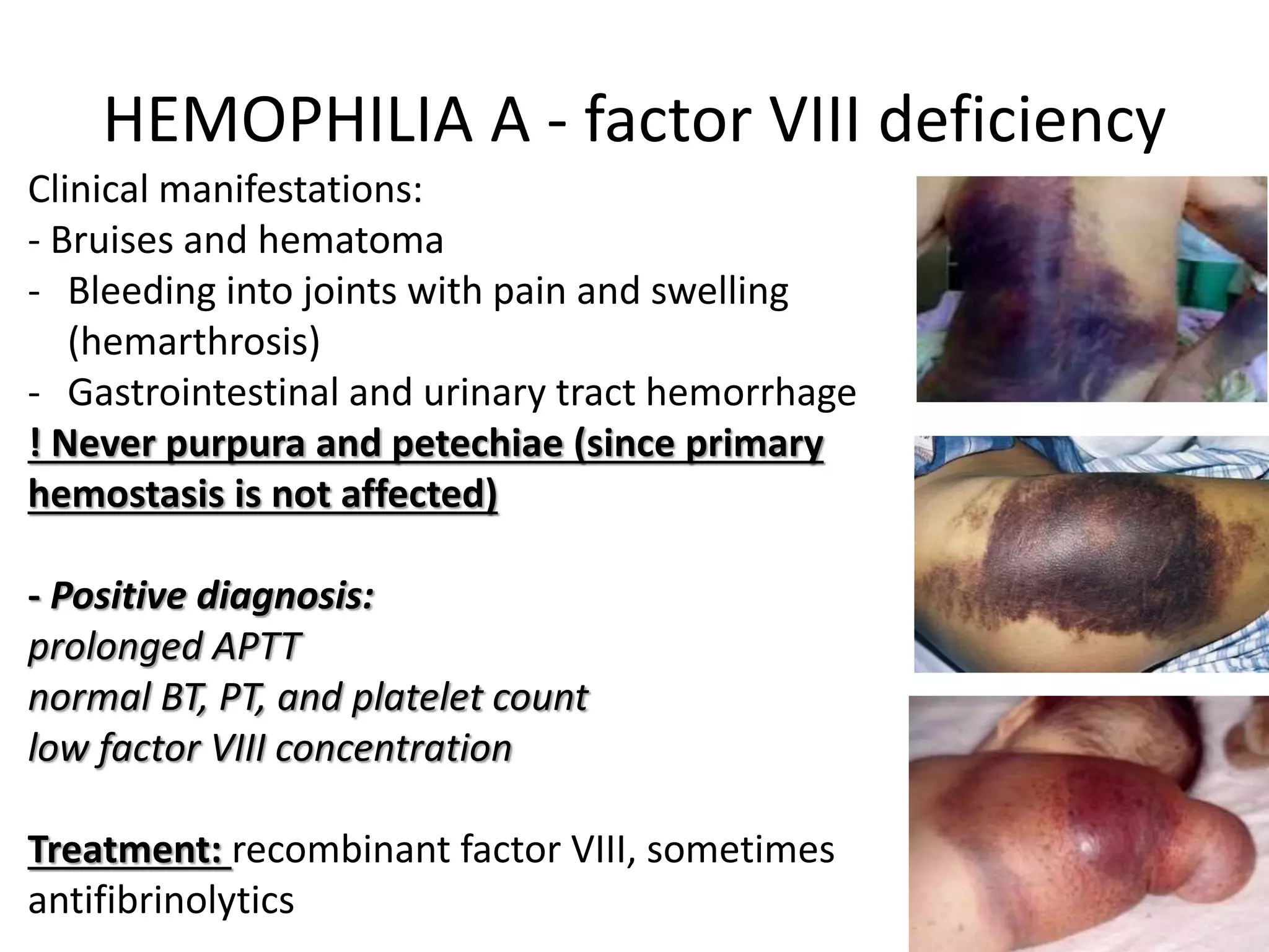 17. HEMOSTASIS DISORDERS.pptx