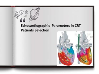 “
Echocardiographic Parameters in CRT
Patients Selection
1
 
