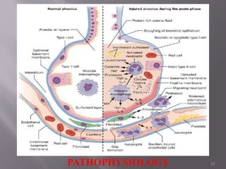 13
PATHOPHYSIOLOGY
 