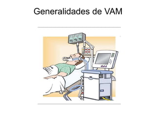 Generalidades de VAM
 