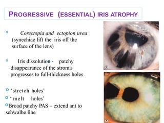 PROGRESSIVE (ESSENTIAL) IRIS ATROPHY

Corectopia and ectopion uvea
(synechiae lift the iris off the
surface of the lens)

Iris dissolution - patchy
disappearance of the stroma
progresses to full-thickness holes
 ‘stretch holes’
 ‘ melt holes’
Broad patchy PAS – extend ant to
schwalbe line
43
 