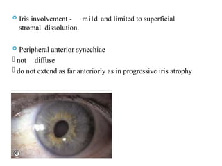  Iris involvement - mild and limited to superficial
stromal dissolution.
 Peripheral anterior synechiae
- not diffuse
- do not extend as far anteriorly as in progressive iris atrophy
 