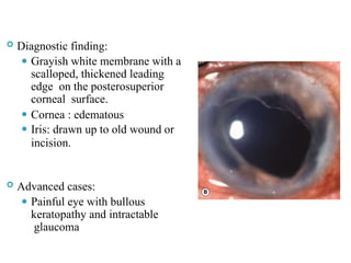  Diagnostic finding:
⚫ Grayish white membrane with a
scalloped, thickened leading
edge on the posterosuperior
corneal surface.
⚫ Cornea : edematous
⚫ Iris: drawn up to old wound or
incision.
 Advanced cases:
⚫ Painful eye with bullous
keratopathy and intractable
glaucoma 62
 
