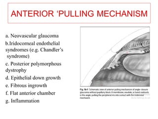 ANTERIOR ‘PULLING MECHANISM
a. Neovascular glaucoma
b.Iridocorneal endothelial
syndromes (e.g. Chandler’s
syndrome)
c. Posterior polymorphous
dystrophy
d. Epithelial down growth
e. Fibrous ingrowth
f. Flat anterior chamber
g. Inflammation
6
 