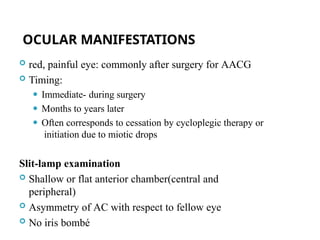 OCULAR MANIFESTATIONS
 red, painful eye: commonly after surgery for AACG
 Timing:
⚫ Immediate- during surgery
⚫ Months to years later
⚫ Often corresponds to cessation by cycloplegic therapy or
initiation due to miotic drops
Slit-lamp examination
 Shallow or flat anterior chamber(central and
peripheral)
 Asymmetry of AC with respect to fellow eye
 No iris bombé
80
 