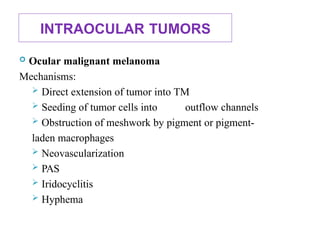 INTRAOCULAR TUMORS
 Ocular malignant melanoma
Mechanisms:
 Direct extension of tumor into TM
 Seeding of tumor cells into outflow channels
 Obstruction of meshwork by pigment or pigment-
laden macrophages
 Neovascularization
 PAS
 Iridocyclitis
 Hyphema
 