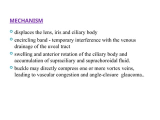 MECHANISM
 displaces the lens, iris and ciliary body
 encircling band - temporary interference with the venous
drainage of the uveal tract
 swelling and anterior rotation of the ciliary body and
accumulation of supraciliary and suprachoroidal ﬂuid.
 buckle may directly compress one or more vortex veins,
leading to vascular congestion and angle-closure glaucoma..
102
 
