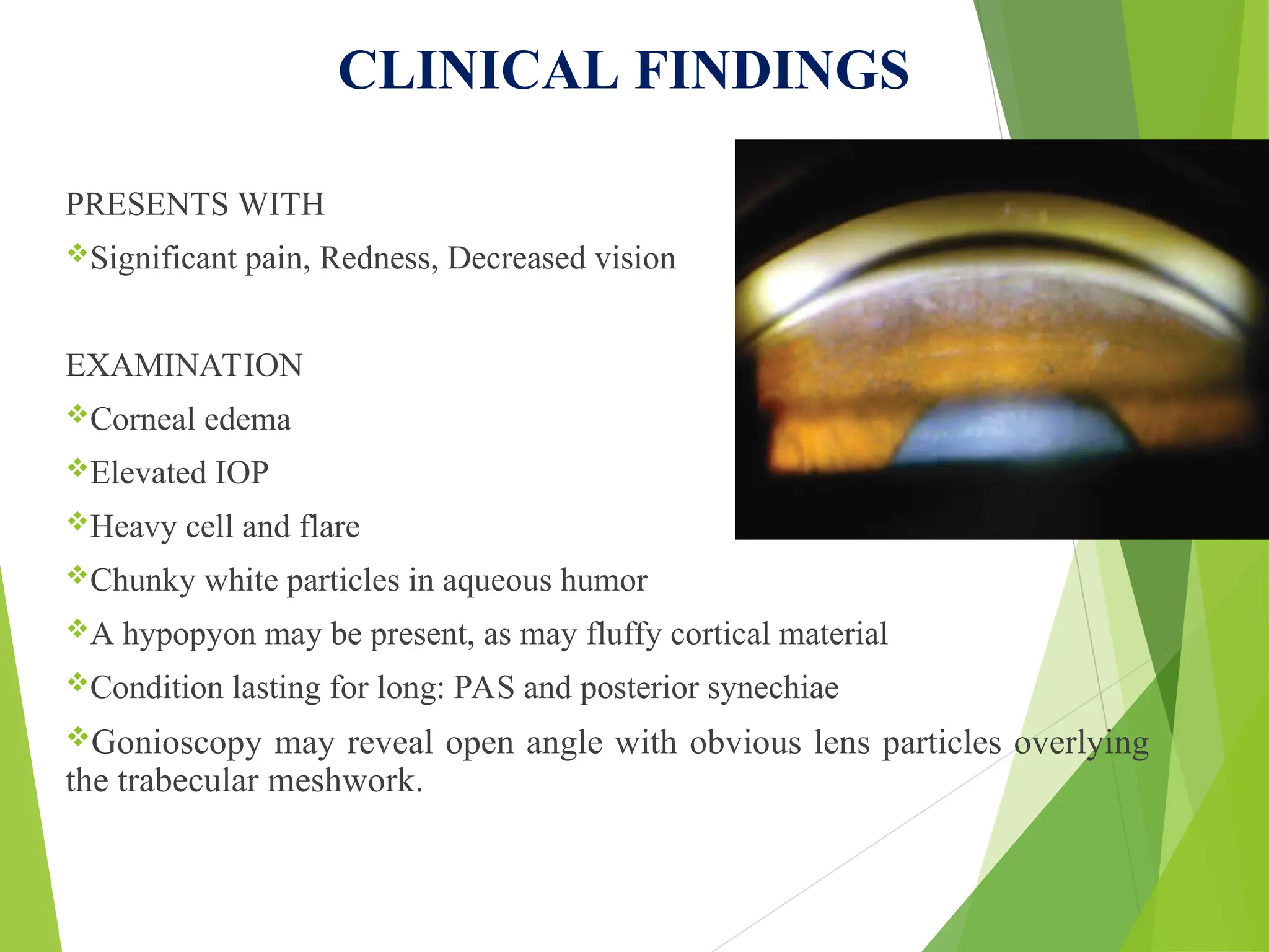 CLINICAL FINDINGS
PRESENTS WITH
Significant pain, Redness, Decreased vision
EXAMINATION
Corneal edema
Elevated IOP
Heavy cell and flare
Chunky white particles in aqueous humor
A hypopyon may be present, as may fluffy cortical material
Condition lasting for long: PAS and posterior synechiae
Gonioscopy may reveal open angle with obvious lens particles overlying
the trabecular meshwork.
 